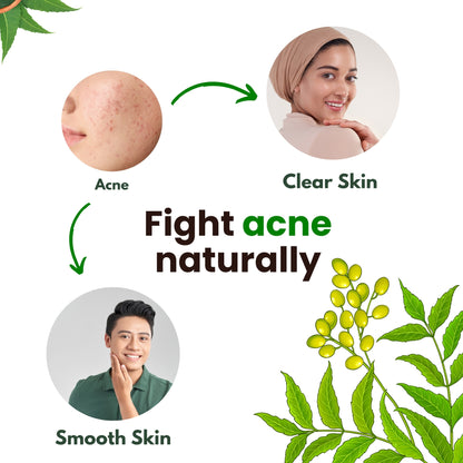 Herbal Neem Essence Face Wash | Remove Acne