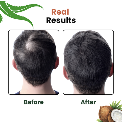 Root Resilience (Anti Hairfall) Shampoo